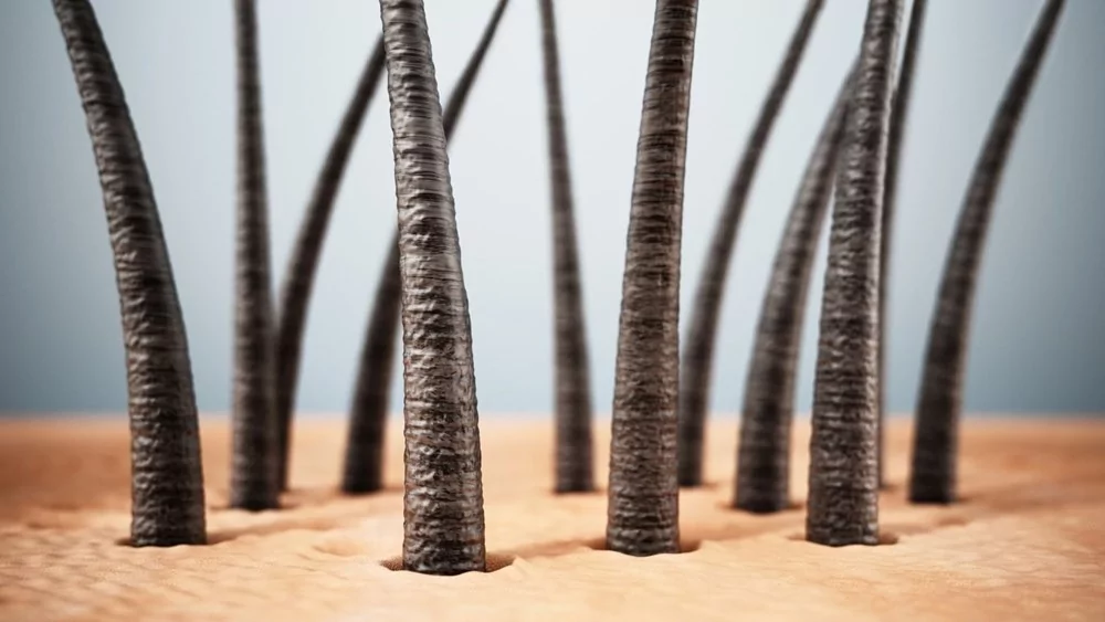 Yeniden popülerlik kazanan saç stili, hastalık yayıyor!