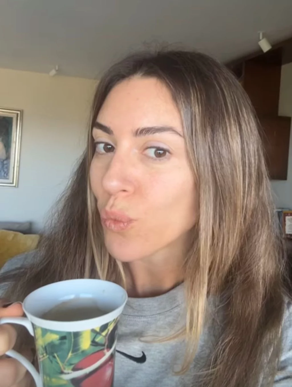 Sinem Kobal estetik iddialarına cevap verdi