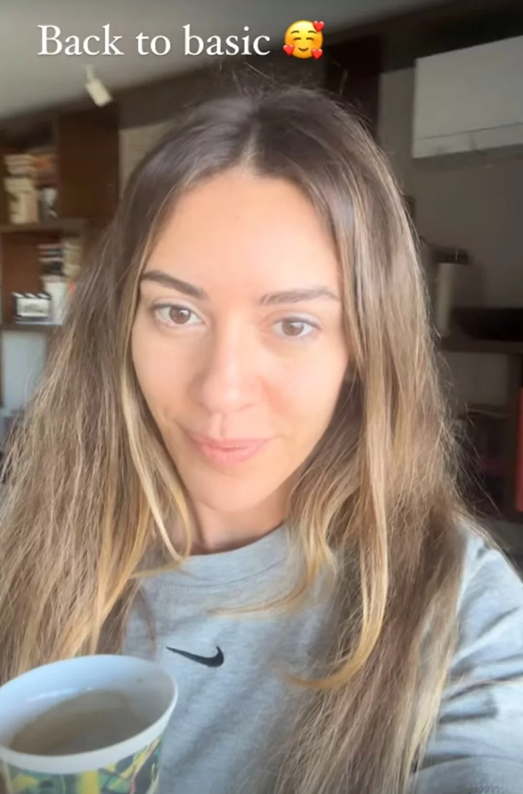 Sinem Kobal estetik iddialarına cevap verdi