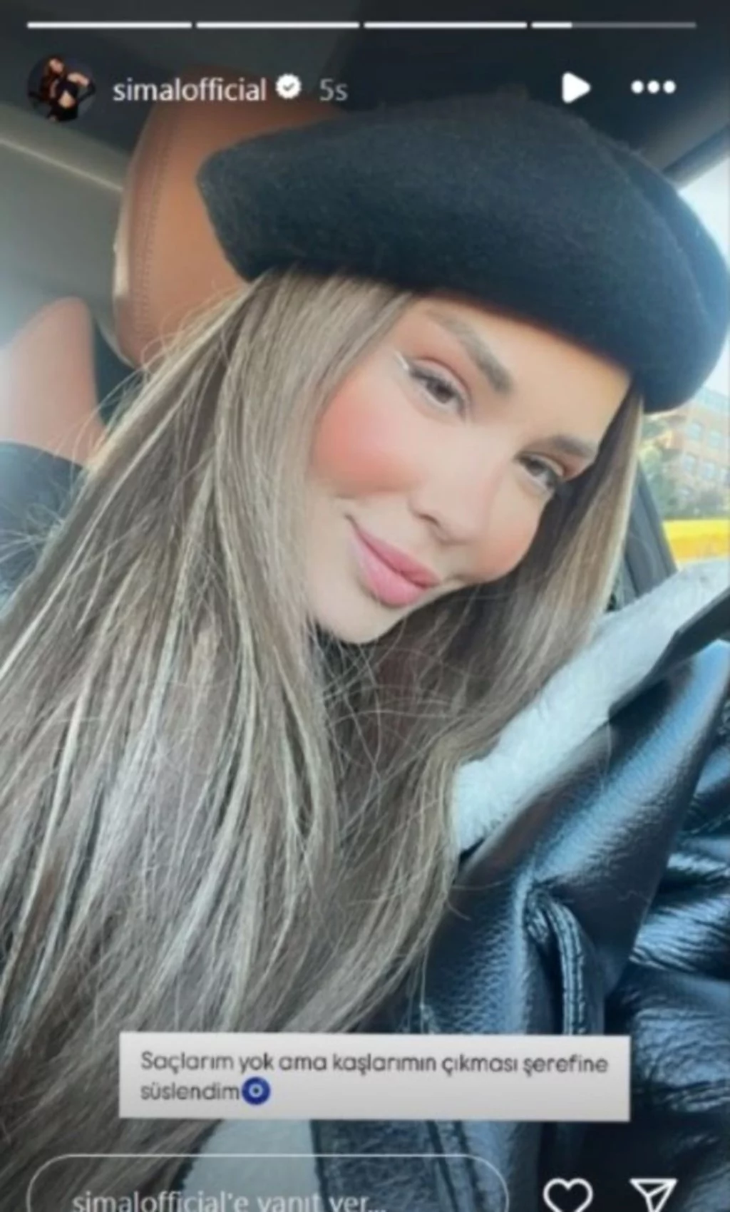 Kanser tedavisi gören Şimal: Kaşlarımın çıkmasının şerefine süslendim