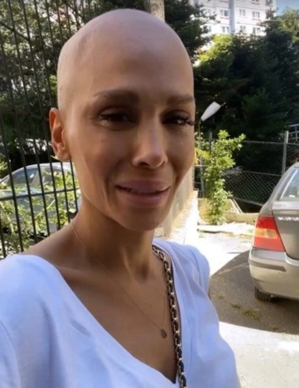 Kanser tedavisi gören Şimal: Kaşlarımın çıkmasının şerefine süslendim