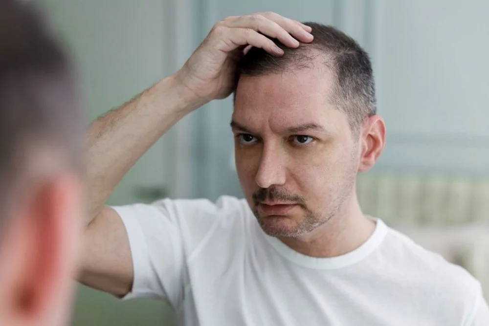 Kel kalıp kalmayacağınızı bilmenin yolu, Çinli araştırmacılarda