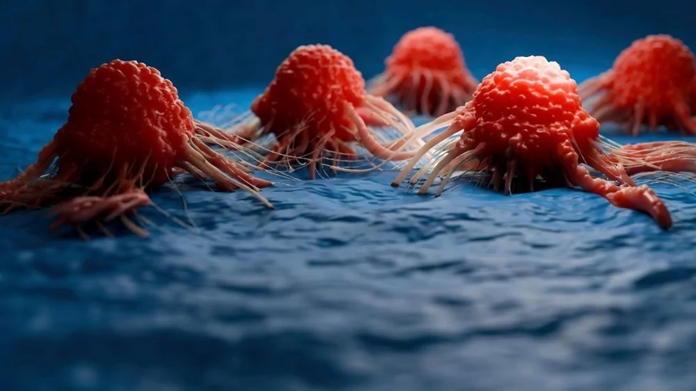 Gençler arasında bağırsak kanseri artıyor!