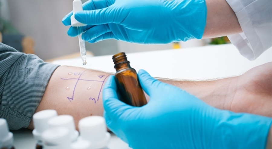 Deri testiyle neye alerjiniz olduğunu öğrenin