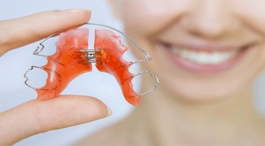 Ortodontik tedavi ile güzel bir gülüşe sahip olabilirsiniz