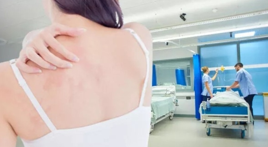 Uzman isimden uyuz için kritik uyarı: Vakalar gün geçtikçe artıyor