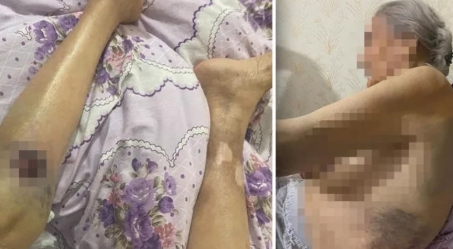 Ankara'da 91 yaşındaki kadın bakıcı dehşeti yaşadı