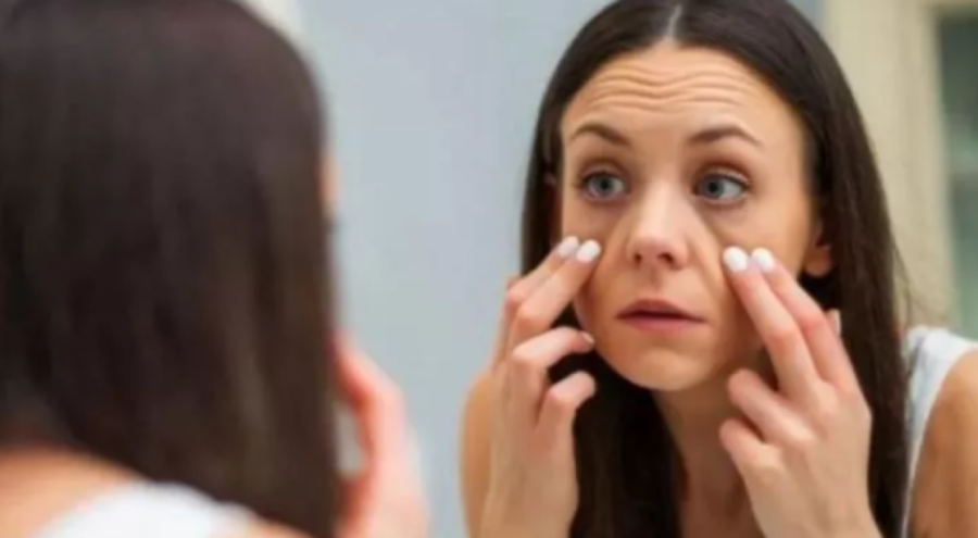 Göz altı torbalanması tedavi edilebilir