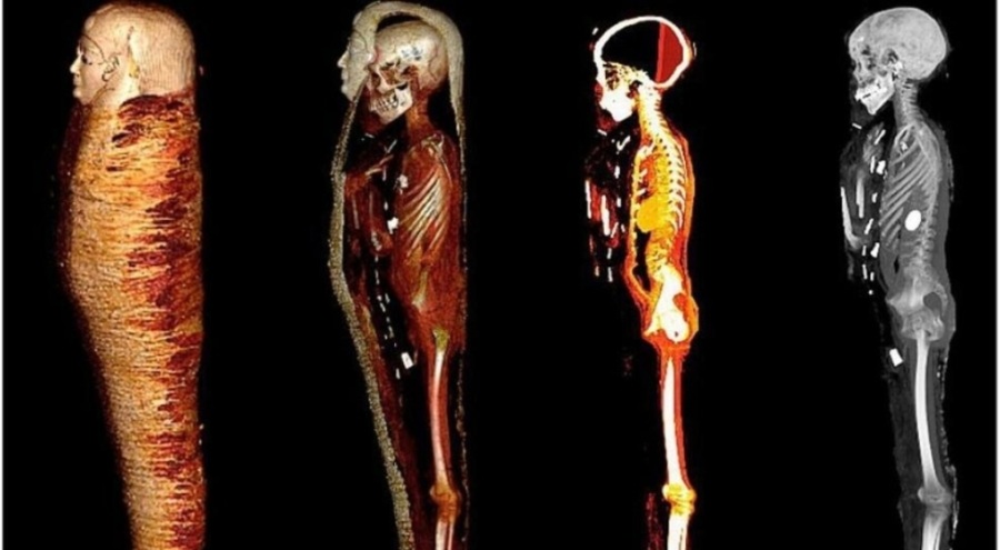 Altın dille gömülen çocuğun sırrı çözülüyor