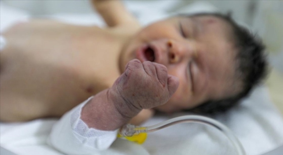 Suriye'de enkazda doğan Eye bebeğin ailesinden kimse kalmadı