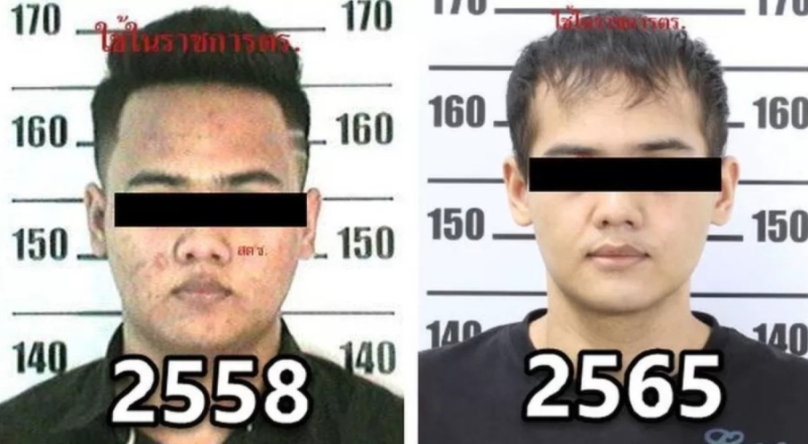 Aranan uyuşturucu satıcısının, estetik operasyon geçirdiği ortaya çıktı!