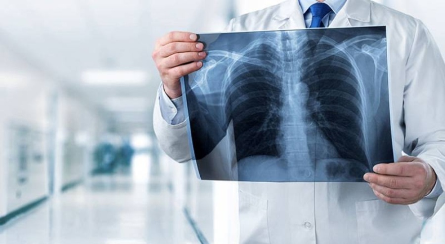 Verem tedavisini reddeden 42 yaşındaki hasta için tutuklama kararı