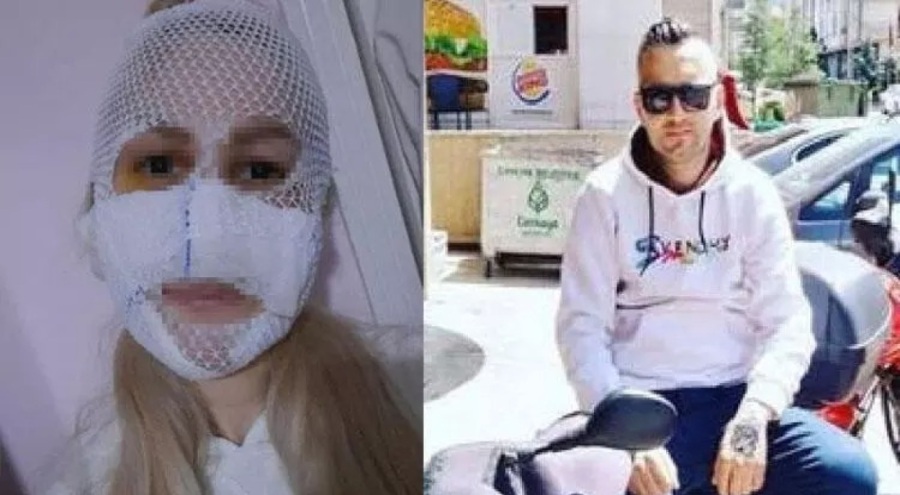 Eski kız arkadaşının yüzüne kimyasal atan sanığın cezasına Yargıtay'dan onama