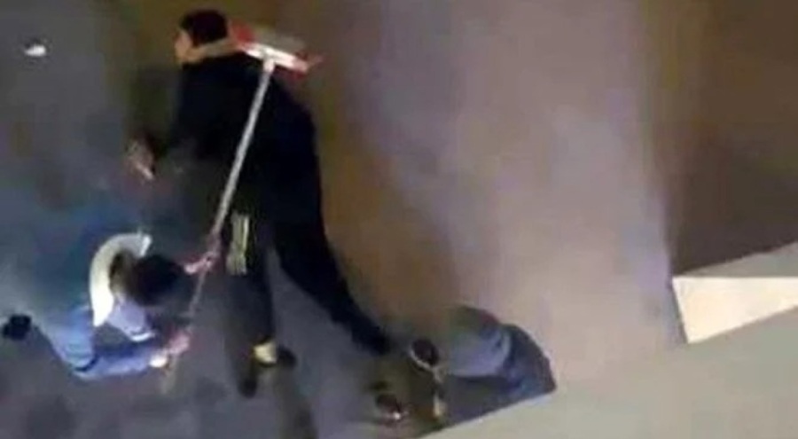 Şaka için serbest bırakılan pitbull 13 yaşındaki çocuğa saldırdı