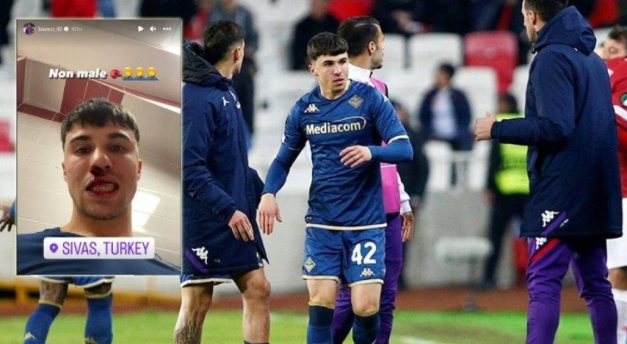 Sivasspor taraftarı, Fiorentinalı oyuncunun burnunu kırdı!