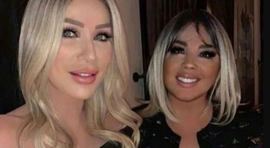 Safiye Soyman estetik oldu!