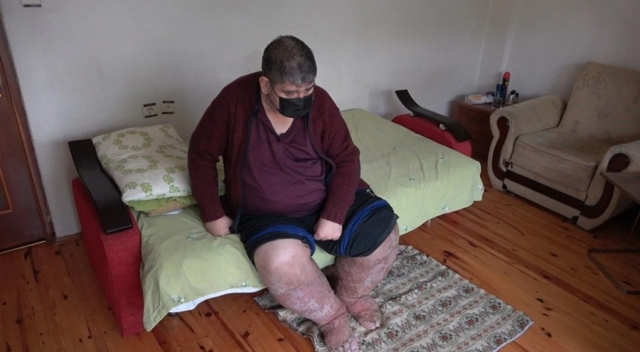 Sivrisineğin ısırdığı güvenlik görevlisi yaşamını yitirdi