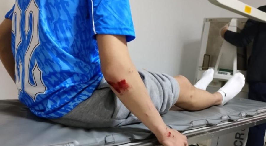 Zonguldak'ta köpeklerin saldırısına uğrayan genç yaralandı