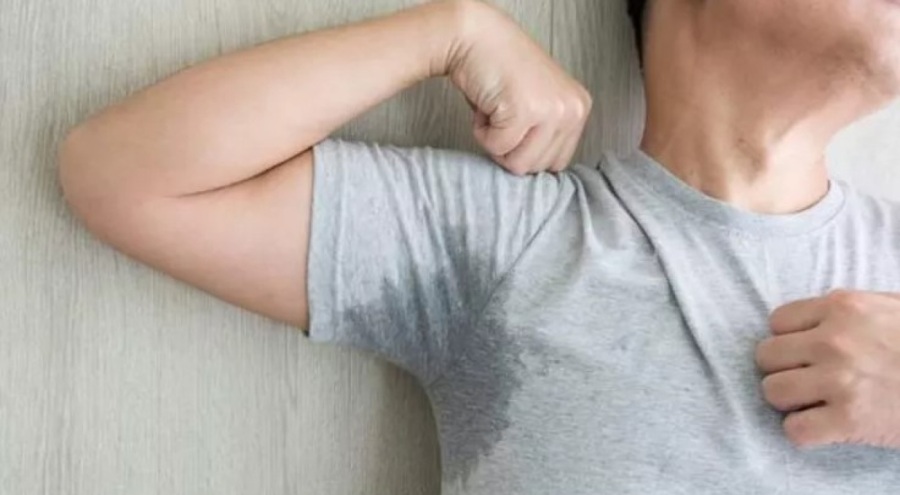 Aşırı terleme tedavi edilmeli