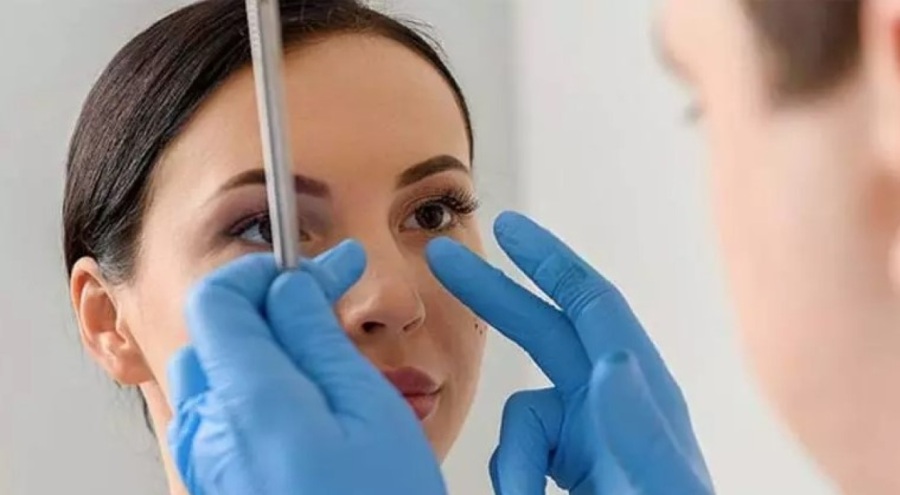 Burun estetiğinde yeni akım: Fenomen burnu