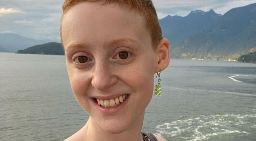 Kanadalı sanatçı Samantha Weinstein 28 yaşında kansere yenik düştü