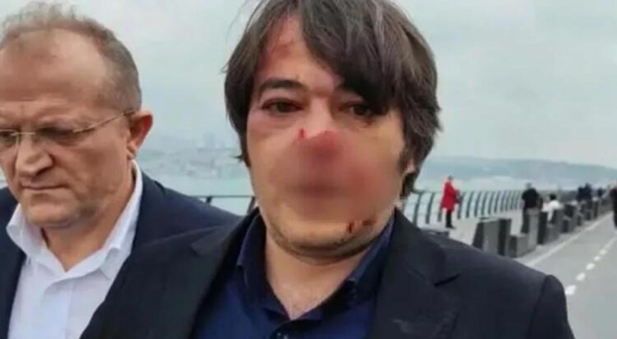 İBB'nin imar şube müdürüne saldırıyla ilgili bir kişi tutuklandı