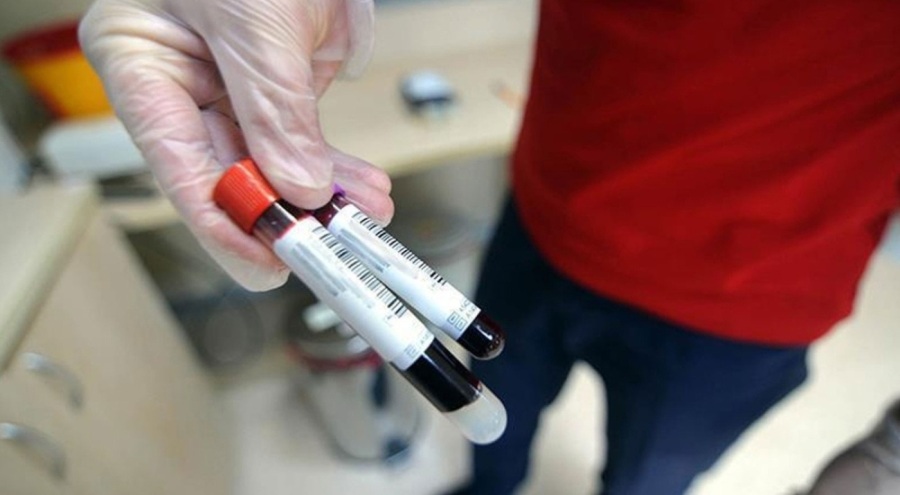 İngiltere'de kan testiyle her üç kanserden ikisi belirlendi