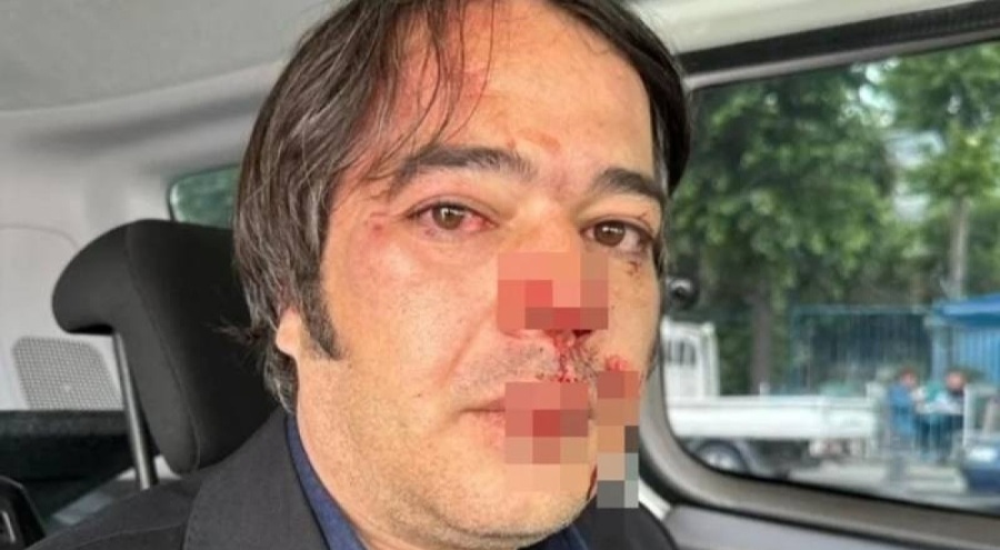 İBB'nin imar şube müdürüne saldırıda tutuklanan şüpheliye tahliye