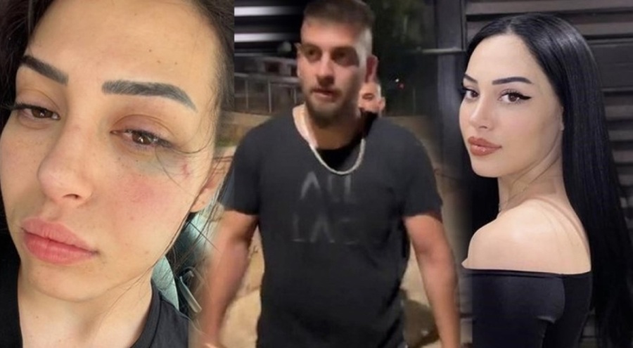 Güney Kıbrıs'ta Türk kızına saldırı: 2 Rum saldırgan gözaltında