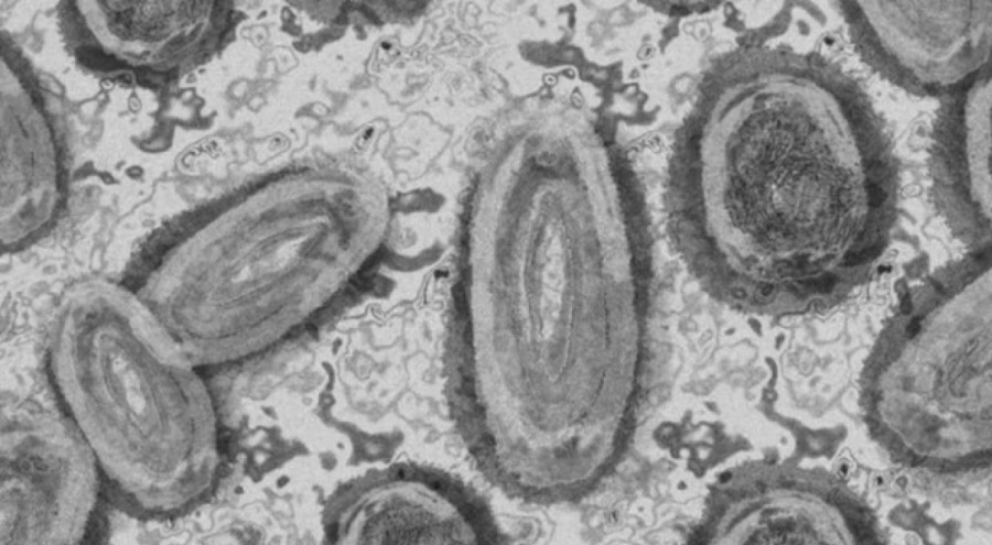 Pekin'de maymun çiçeği virüsü görüldü