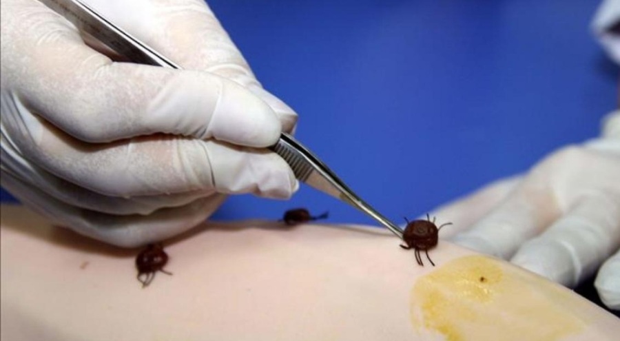 'Kırım Kongo Kanamalı Ateşi' hastalığı can aldı