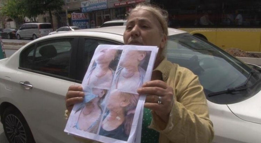 Sancaktepe'de diş tedavisine giden kadın kâbusu yaşadı: Narkoz sonrası yoğun bakıma alındı