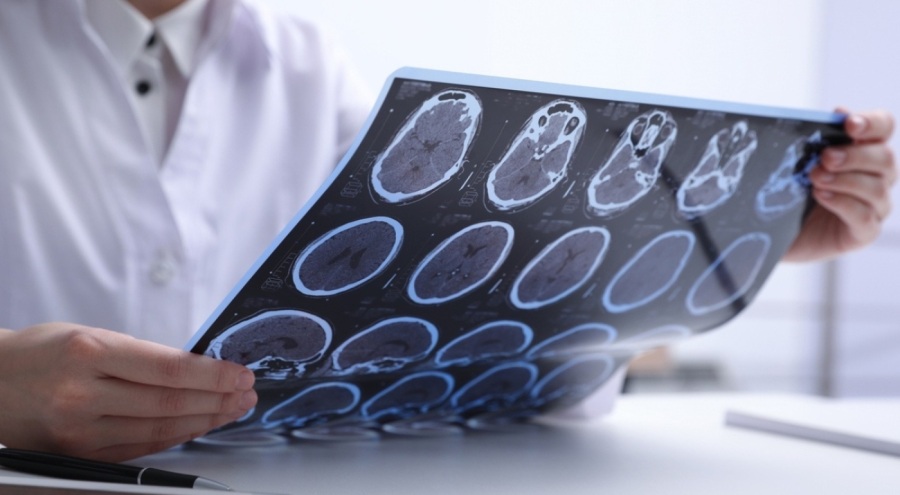 Binlerce hasta ilaçsız kaldı! SGK MS ilaçlarını pasife aldı