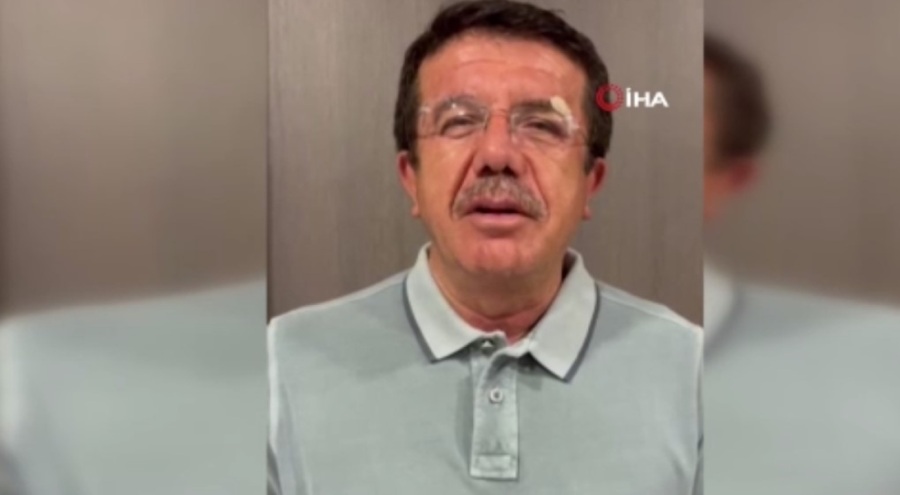 Kaza geçiren eski Bakan Zeybekci'den açıklama