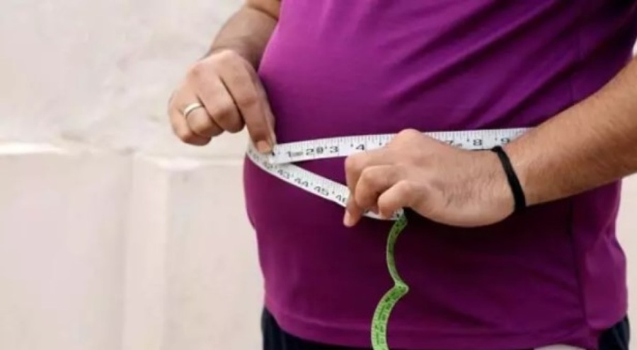 Obezite ameliyatlarında midenin yaklaşık yüzde 80'i alınır