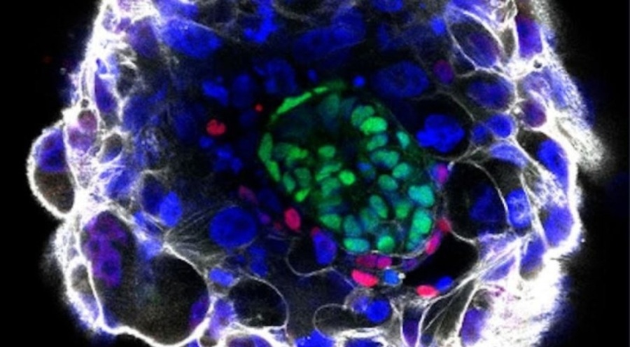 Sentetik insan embriyosu üretildi