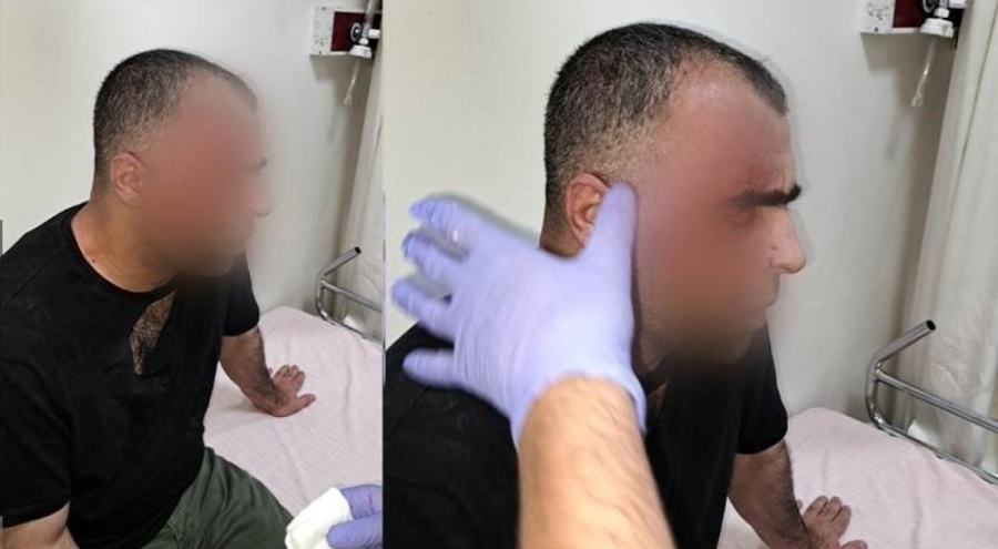 Gazeteci Sinan Aygül'e saldırı: Bir daha başkan hakkında yazarsan...