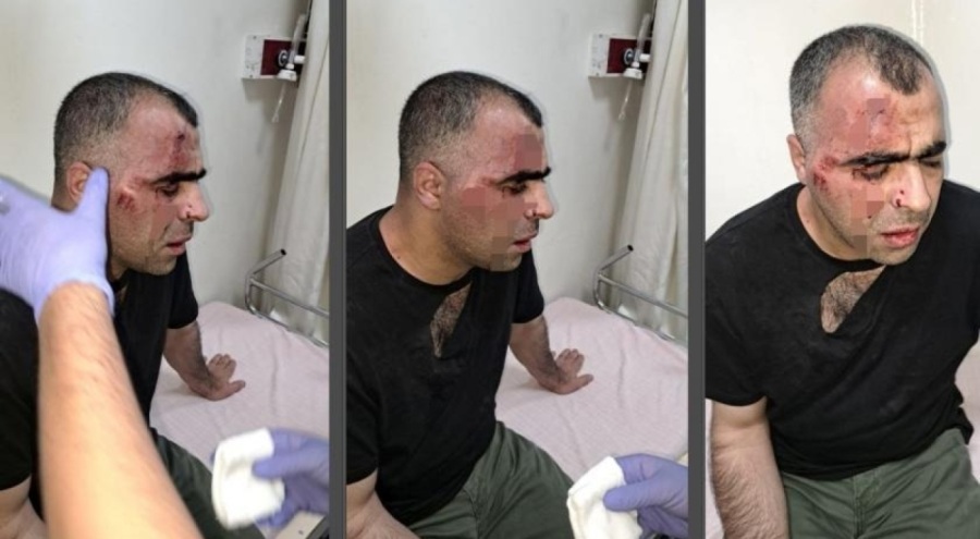 Gazeteci Aygül'e saldıran belediye çalışanı ile bir polis açığa alındı