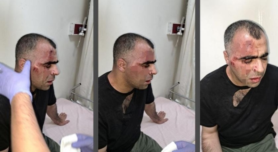 Sinan Aygül'e saldırmışlardı! Belediye çalışanı ile bir polis tutuklandı