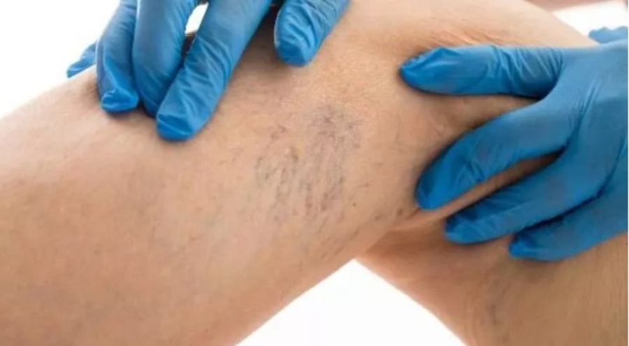 Evden çalışma varis vakalarını artırıyor