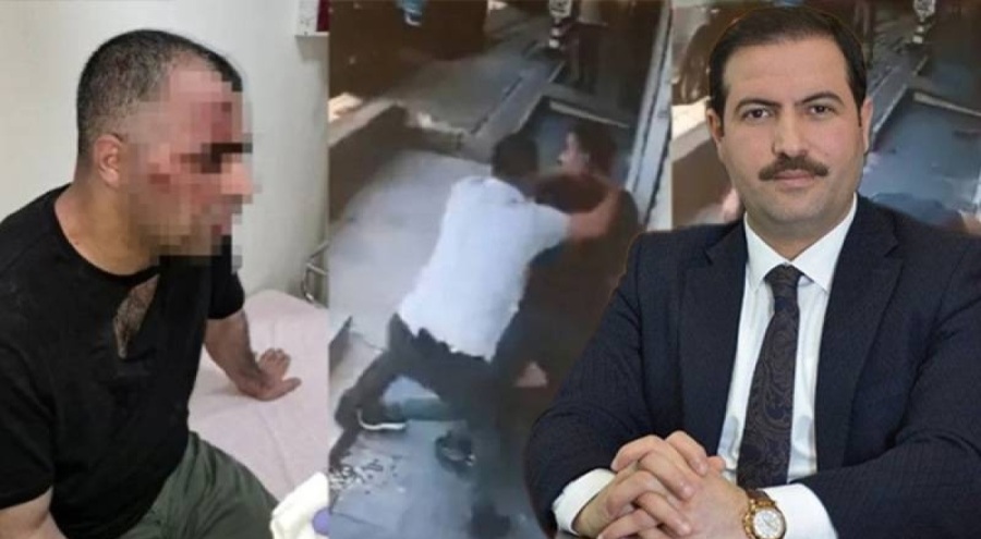 Korumaları gazeteci Sinan Aygül'ü darbetmişti: AK Partili Belediye Başkanı özür diledi