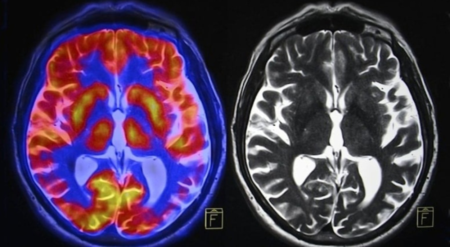 İnsanların beyni küçülüyor