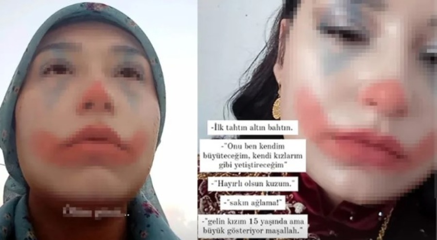 Elma Şekeri koruma altına alındı