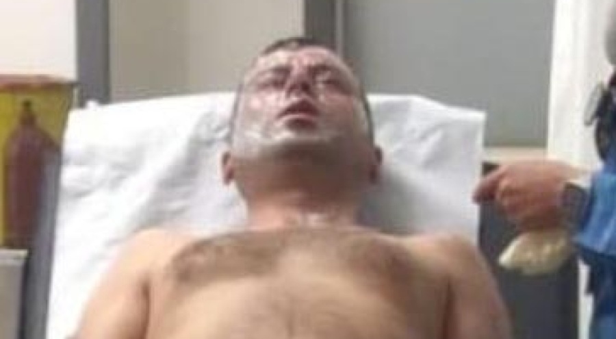 Lavabo açıcının patlamasıyla yaralandı