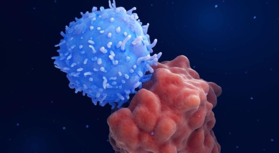 Yumurtalık kanserini erken teşhis eden proteinler keşfedildi!