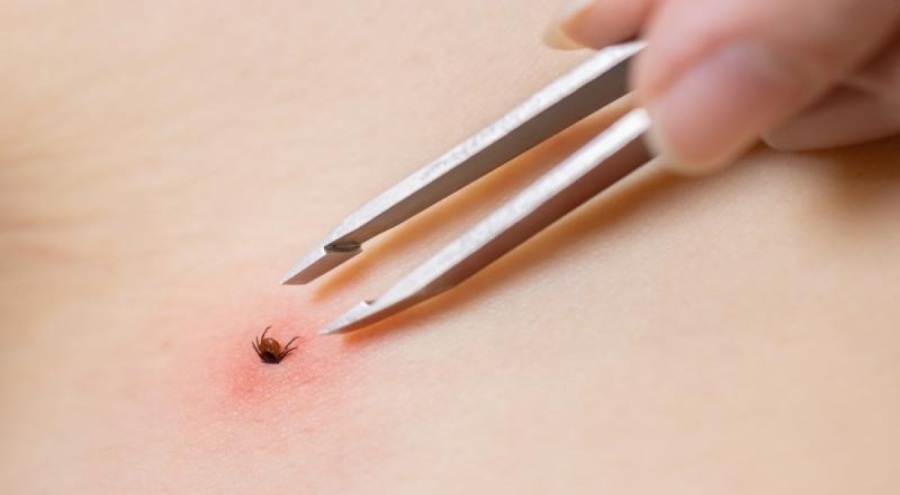 Hava sıcaklıkları yükseldi, kene vaka sayısı arttı