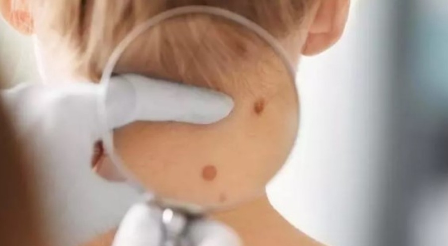 Güneş ışınlarına doğrudan maruz kalmayın!