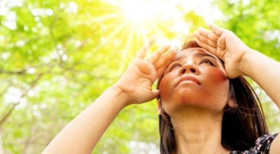 Uzmandan uyarı: Güneşle gelen cilt lekelerine dikkat