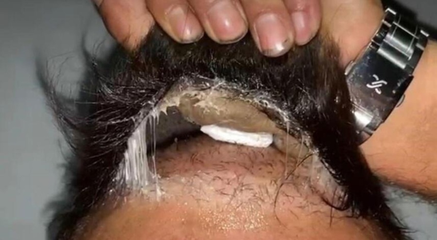 Hatay'da şüphelinin peruğunda uyuşturucu bulundu