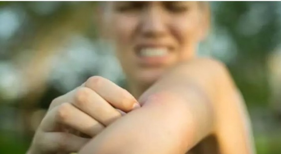 Havaların ısınmasıyla akrep ve yılan ısırmaları arttı